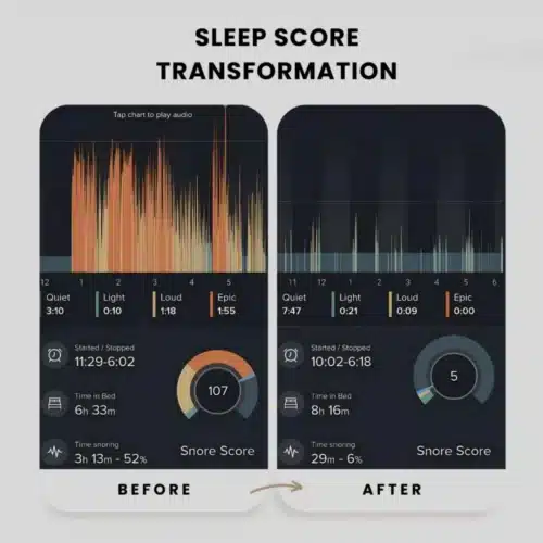 Sleepzee (anti-snoring Device): Official Website